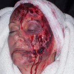 The Boston Face Painters - Special Effects Makeup - Bloody Woman